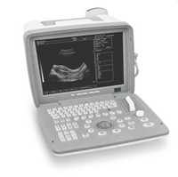 Portable Ultrasound ,Medical Instrument