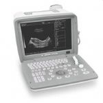 Portable Ultrasound 